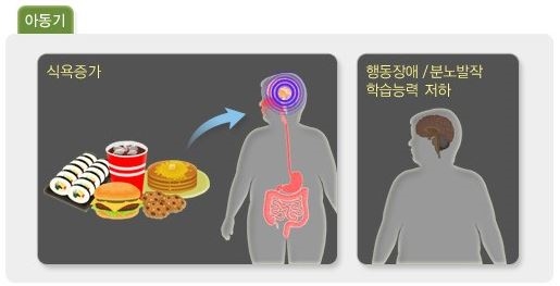 아동기 그림 – 왼쪽 음식을 보고 식욕증가된 뇌와 오른쪽 행동장애/분노발작, 학습능력 저하와 관련된 뇌